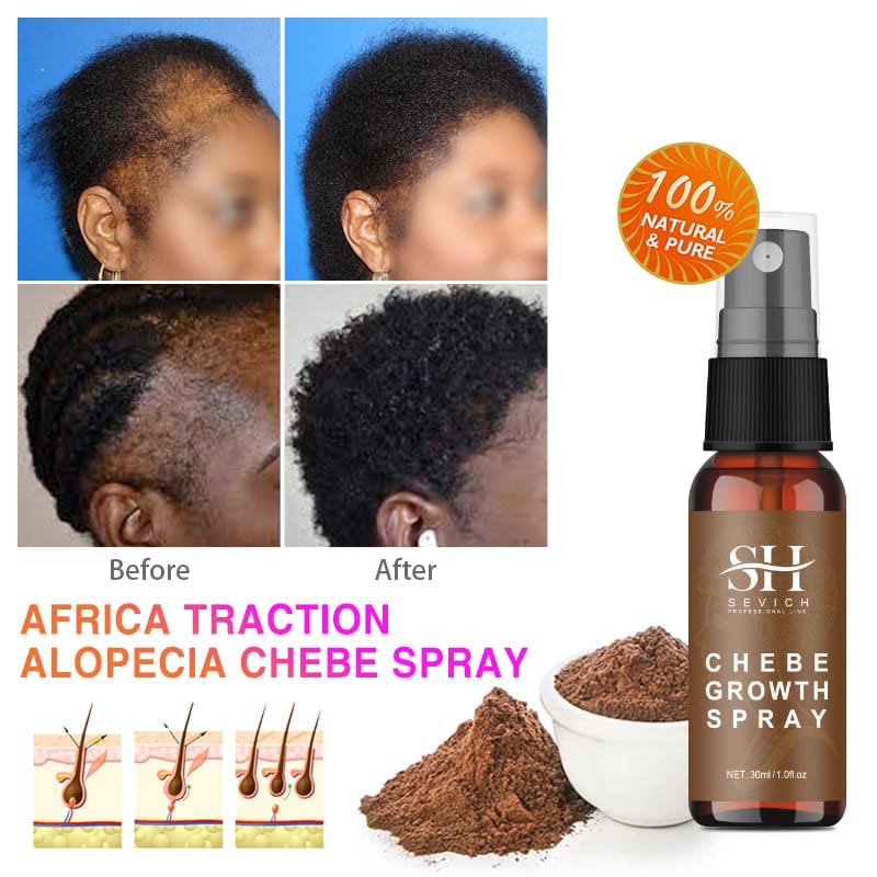chebe powder hair growth - 19