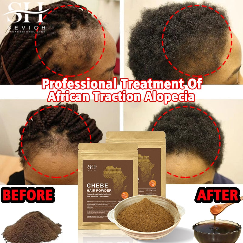 chebe powder hair growth - 18